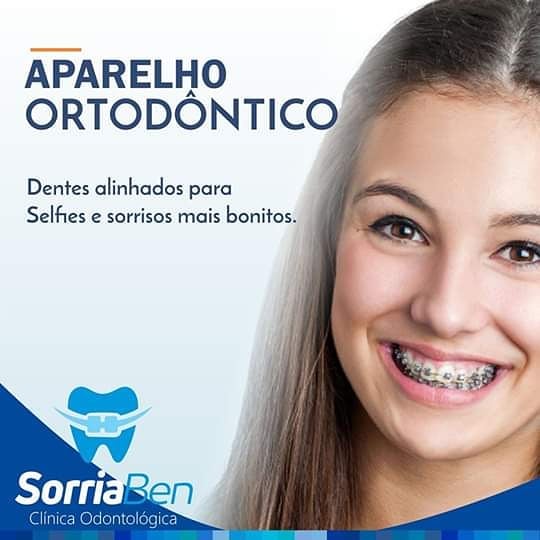 Aparelho Ortodôntico