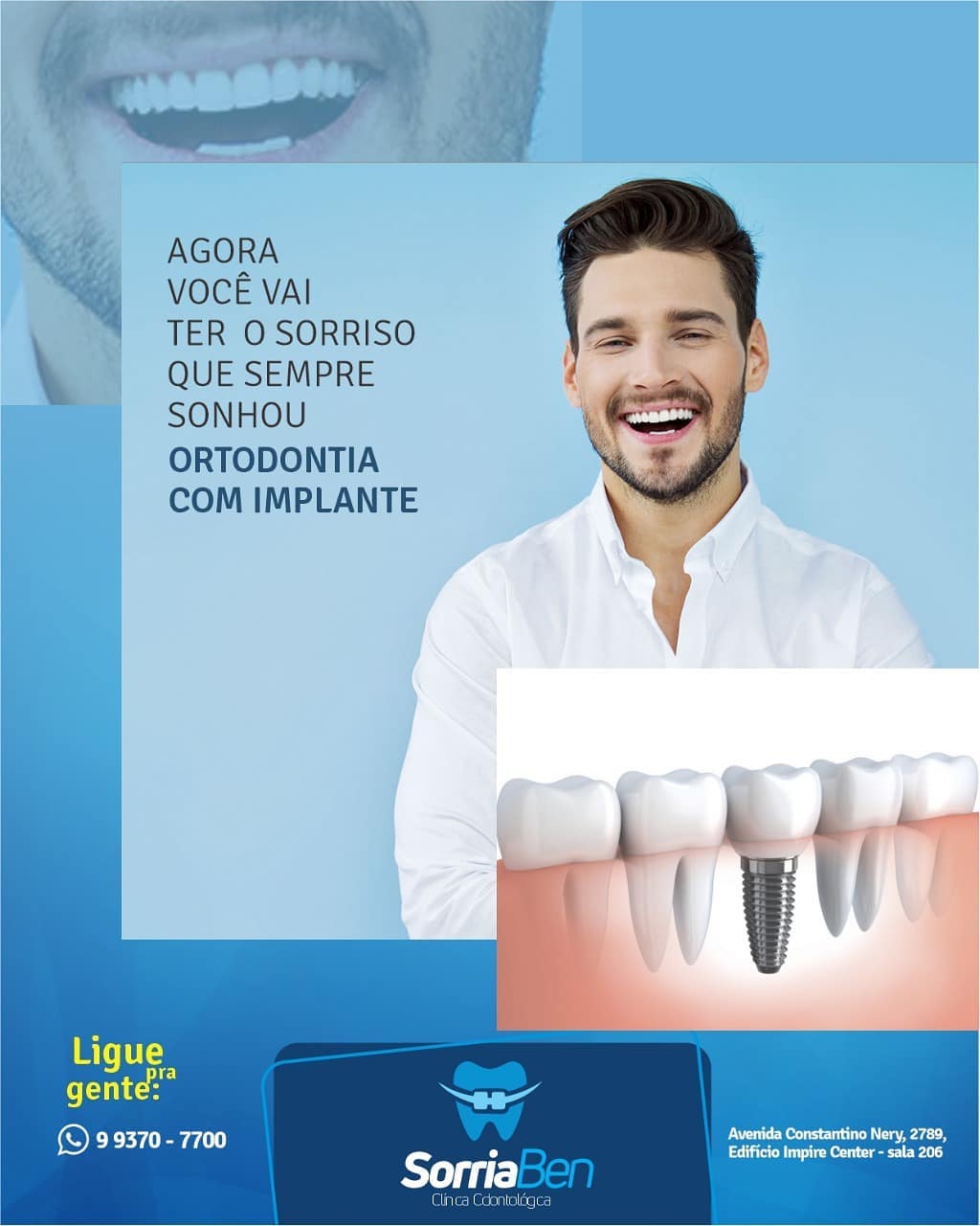 Invisalign